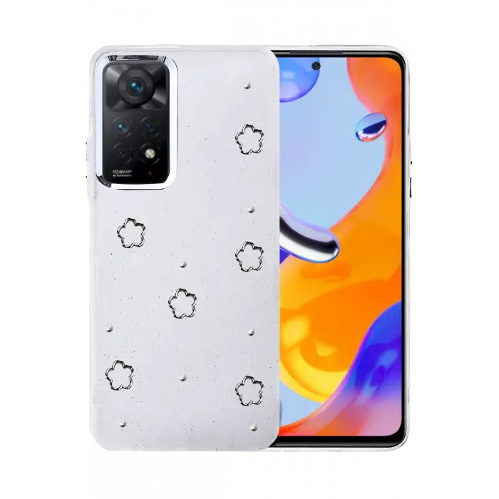 Lopard Xiaomi Redmi Note 11 Pro Fiyonk Desenli Kapak - Desen 8