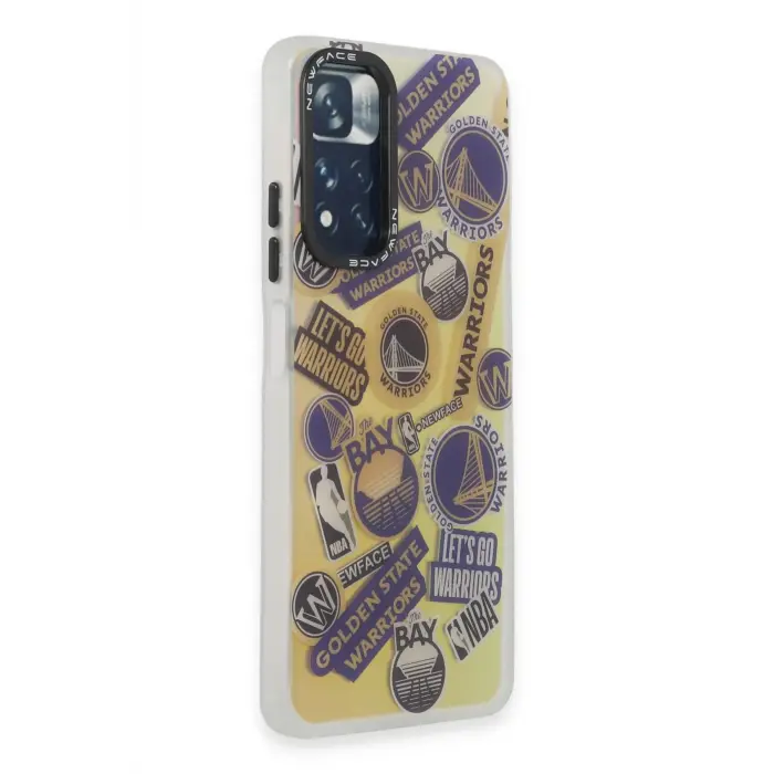 Lopard Xiaomi Redmi Note 11 Pro Kılıf Estoril Desenli Kapak - Estoril - 13