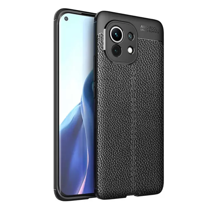 Xiaomi Mi 11 Kılıf Lopard Kamera Korumalı Deri Orjinal Görünümlü Kapak Niss
