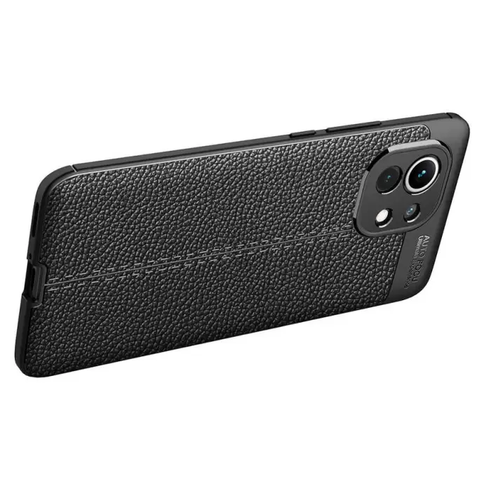 Xiaomi Mi 11 Kılıf Lopard Kamera Korumalı Deri Orjinal Görünümlü Kapak Niss