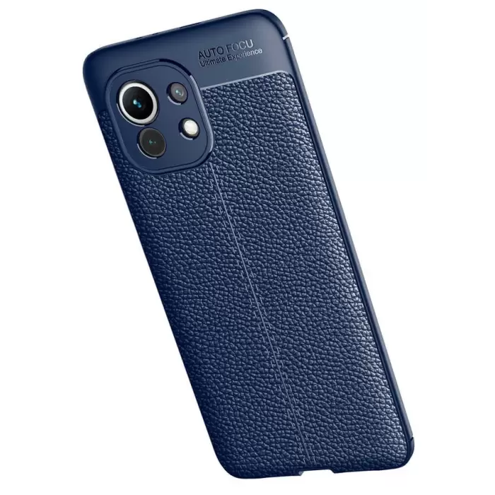 Xiaomi Mi 11 Kılıf Lopard Kamera Korumalı Deri Orjinal Görünümlü Kapak Niss