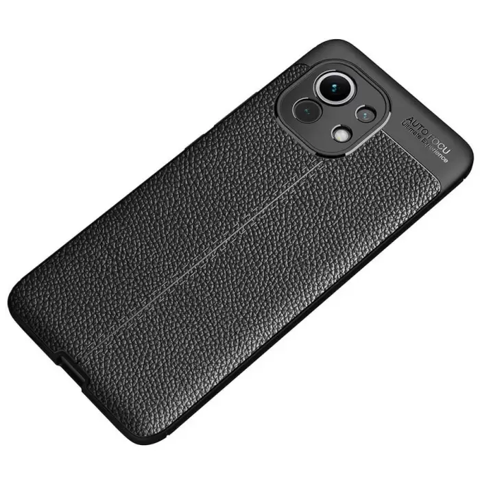 Xiaomi Mi 11 Kılıf Lopard Kamera Korumalı Deri Orjinal Görünümlü Kapak Niss