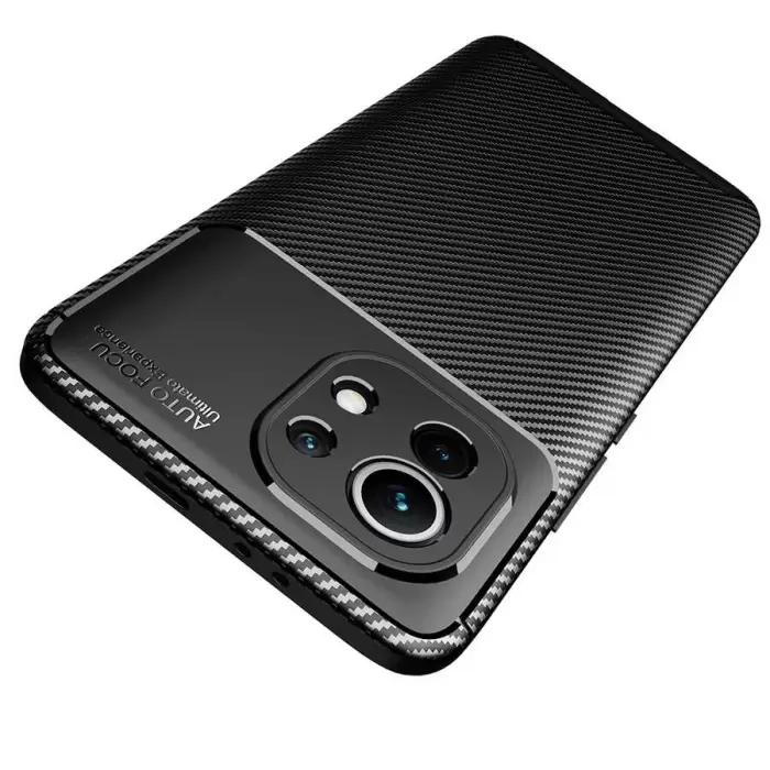Xiaomi Mi 11 Kılıf Lopard Kamera Korumalı Karbon Desenli Negro Kapak Orijinal Yüzey Kılıf