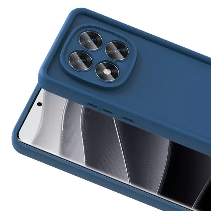 Xiaomi Poco X7 Kılıf Kamera Korumalı Lopard Ananas Kapak