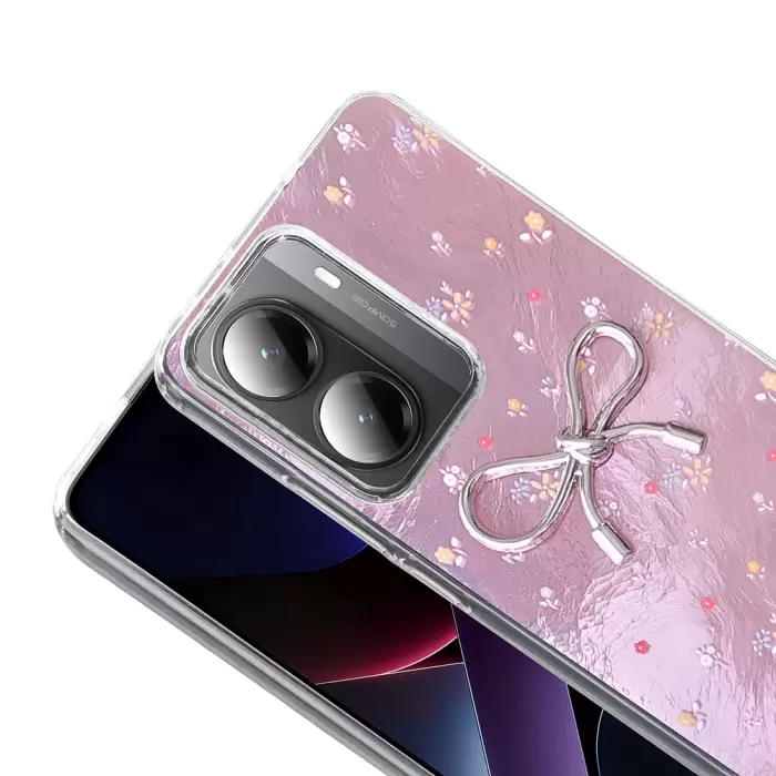 Xiaomi Poco X7 Pro Kılıf Kamera Korumalı Figürlü Lopard Ponti Silikon Kapak