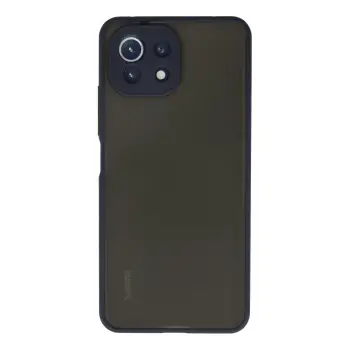 Lopard Xiaomi Mi 11 Lite Kılıf Montreal Silikon Kapak - Lacivert