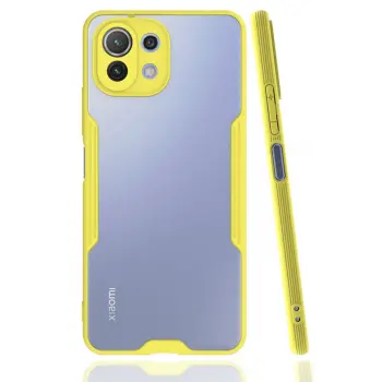 Lopard Xiaomi Mi 11 Lite Kılıf Platin Silikon - Sarı