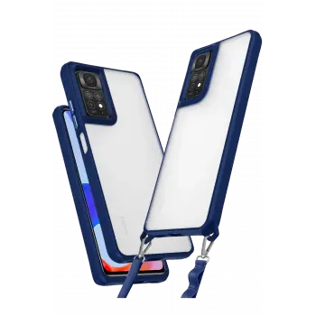 Lopard Xiaomi Redmi Note 11 Pro Kılıf Penta Silikon Kılıf - Lacivert