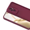 Honor 200 Kılıf Kamera Korumalı Lopard Ananas Kapak