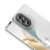 Honor 200 Pro Kamera Lens Korumalı Şeffaf Renkli Logo Gösteren Omega Kapak