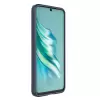 Tecno Spark 20c Kılıf Esnek Tpu Oyuklu Arka Yüzey Tasarımlı Lopard Etnik Silikon Kapak