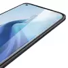 Xiaomi Mi 11 Kılıf Lopard Kamera Korumalı Deri Orjinal Görünümlü Kapak Niss