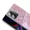 Xiaomi Poco X7 Pro Kılıf Kamera Korumalı Figürlü Lopard Ponti Silikon Kapak