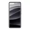 Xiaomi Redmi Note 14 Pro 5g Kılıf Lopard Kamera Korumalı Karbon Desenli Negro Kapak Yüzey Kılıf
