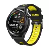 Xiaomi Redmi Watch 5 Active Lopard Çift Renkli Kordon Krd-55 Uyumlu Silikon Tasarım Kordon