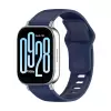 Xiaomi Redmi Watch 5 Active Lopard Klasik Kordon