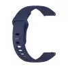 Xiaomi Redmi Watch 5 Active Lopard Klasik Kordon