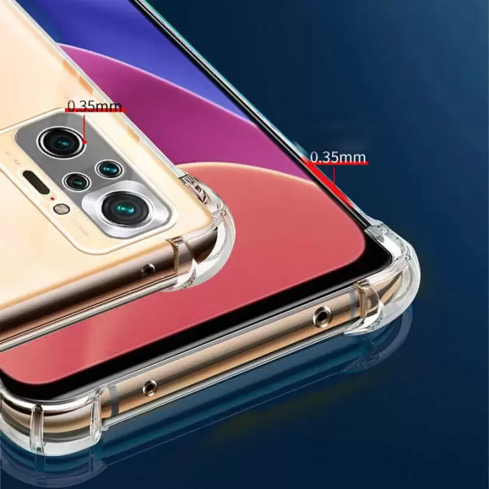 Xiaomi Poco M5S Kılıf Lopard Kamera Korumalı Nitro Antishock Köşe Koruma Darbe Emici Şeffaf Orjinal Doku Silikon