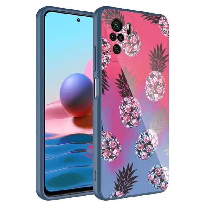 Xiaomi Redmi Note 10S Kılıf Kamera Korumalı Desenli Sert Silikon Lopard Epoksi Kapak