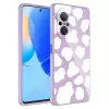 Huawei Nova 9 SE Kılıf Kamera Korumalı Desenli Sert Silikon  Epoksi Kapak