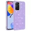 Xiaomi Redmi Note 11 Pro 5G Kılıf Renkli Simli Kamera Çıkıntılı Parlak Shining Arka Kapak