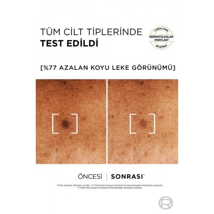 Loreal Paris Bright Reveal Sivilce, Güneş,yaşlanma Lekelerinde Etkili Koyu Leke Karşıtı Serum 7.5%niasinamid 30ml