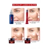 Loreal Paris Revitalift Lazer X3 Leke ve Kırışıklık Karşıtı Bakım GKF25 SPF25