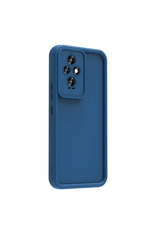 Honor 200 Kılıf Kamera Korumalı Zore Ananas Kapak