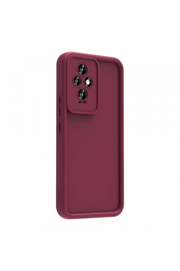 Honor 200 Kılıf Kamera Korumalı Zore Ananas Kapak