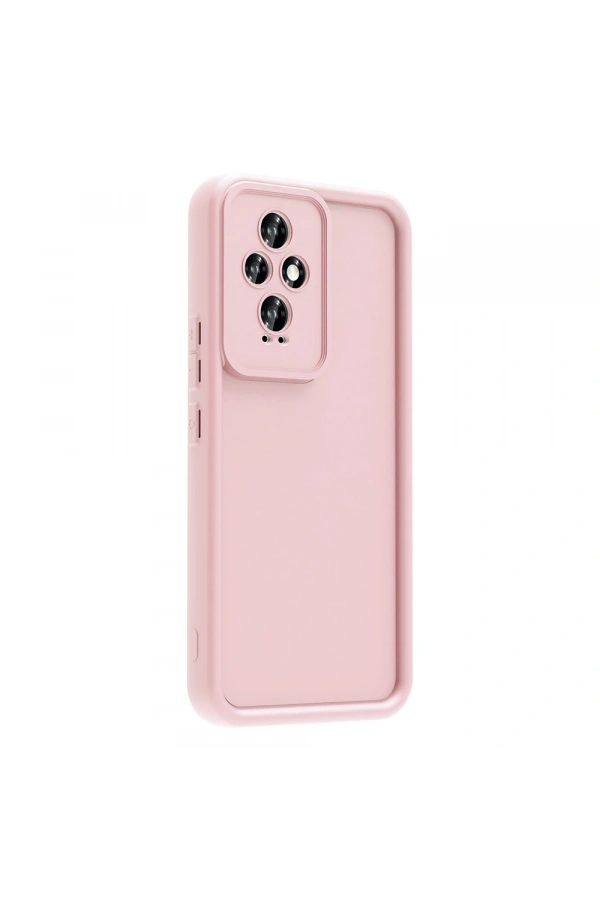 Honor 200 Kılıf Kamera Korumalı Zore Ananas Kapak