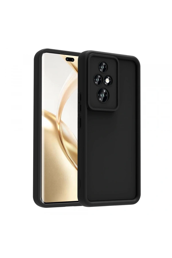 Honor 200 Pro Kılıf Kamera Korumalı Zore Ananas Kapak