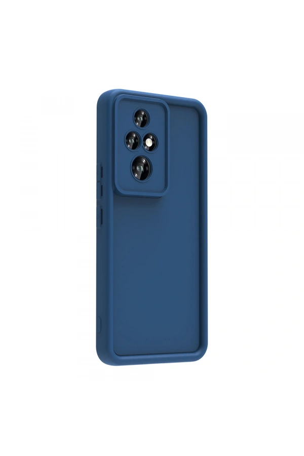 Honor 200 Pro Kılıf Kamera Korumalı Zore Ananas Kapak