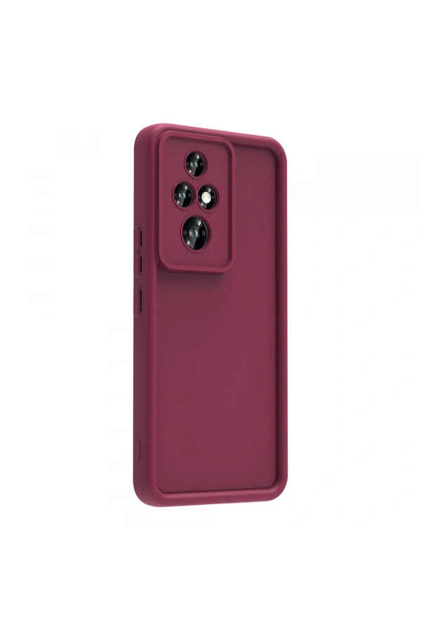 Honor 200 Pro Kılıf Kamera Korumalı Zore Ananas Kapak