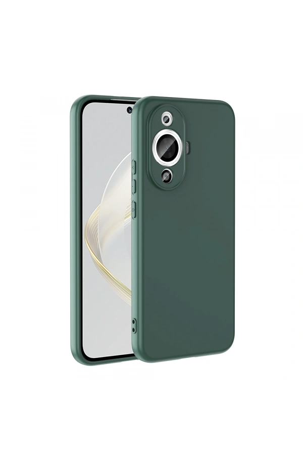 Huawei Nova 12S Kılıf Zore Mara Lansman Kapak