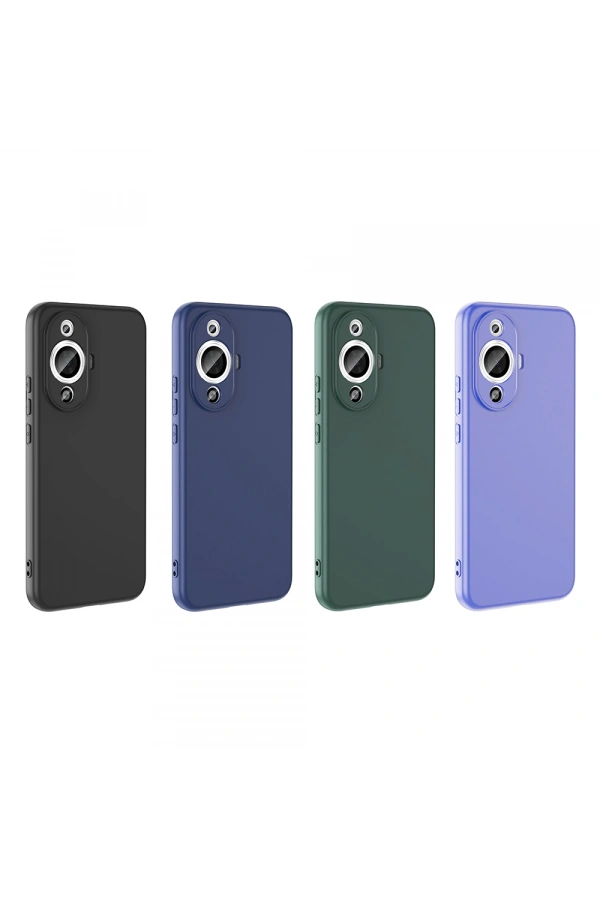 Huawei Nova 12S Kılıf Zore Mara Lansman Kapak