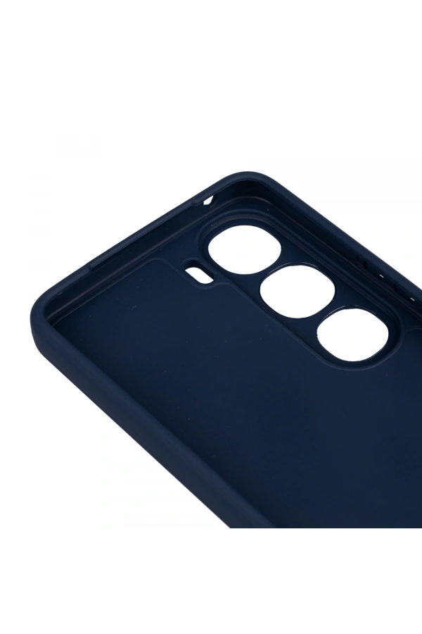 Vivo V40 Lite Kılıf Zore Biye Silikon