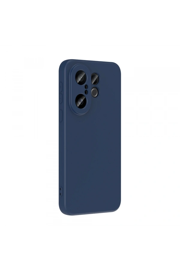 Vivo X200 FE 5G Kılıf Zore Mara Lansman Kapak