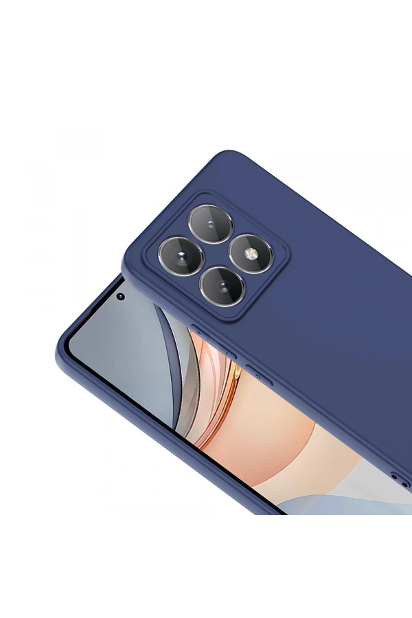 Xiaomi 14T Kılıf Zore Mara Lansman Kapak