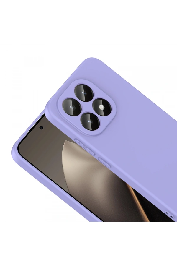 Xiaomi 15T Kılıf Zore Mara Lansman Kapak