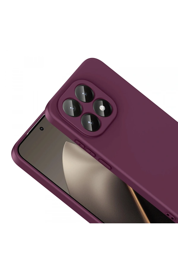 Xiaomi 15T Kılıf Zore Mara Lansman Kapak