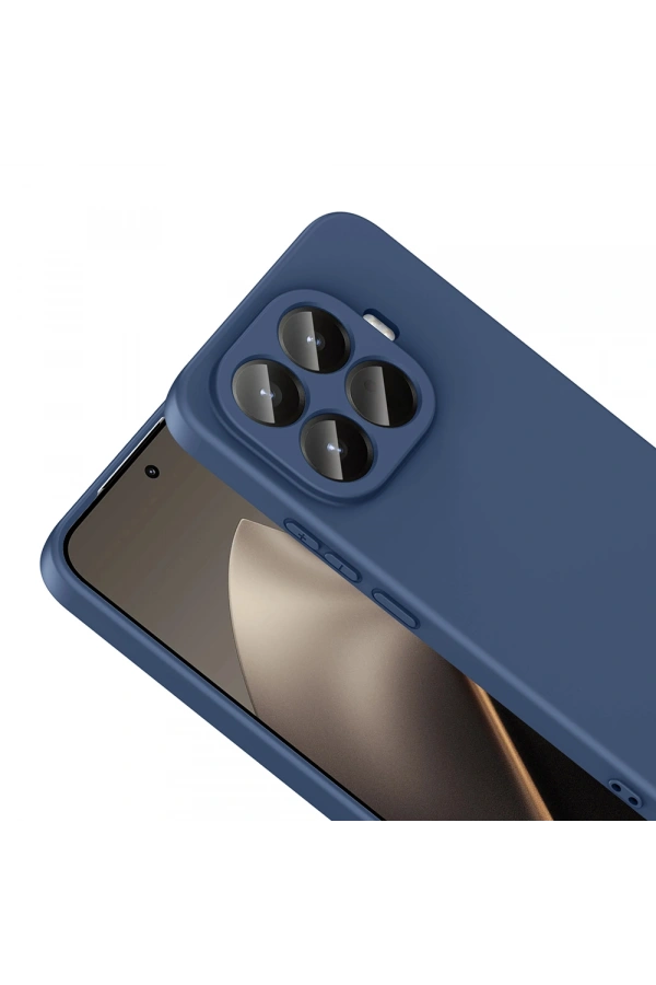 Xiaomi 15T Pro Kılıf Zore Mara Lansman Kapak