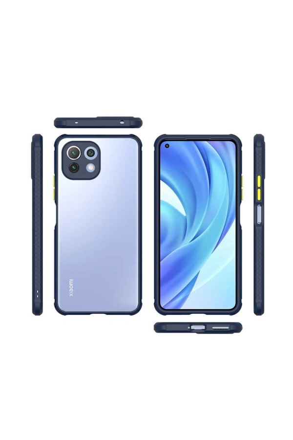 Xiaomi Mi 11 Lite Kılıf ​​Zore Kaff Kapak