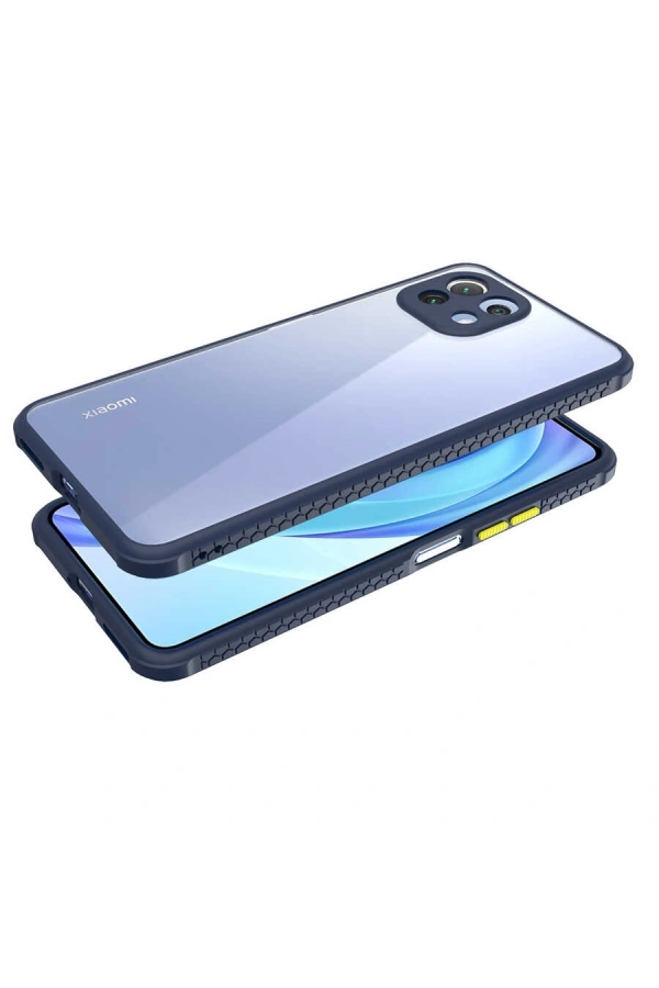 Xiaomi Mi 11 Lite Kılıf ​​Zore Kaff Kapak