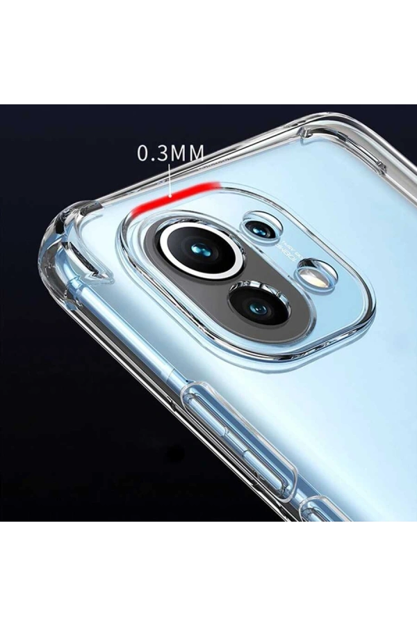 Xiaomi Mi 11 Lite Kılıf Zore Kamera Korumalı Nitro Anti Shock Silikon