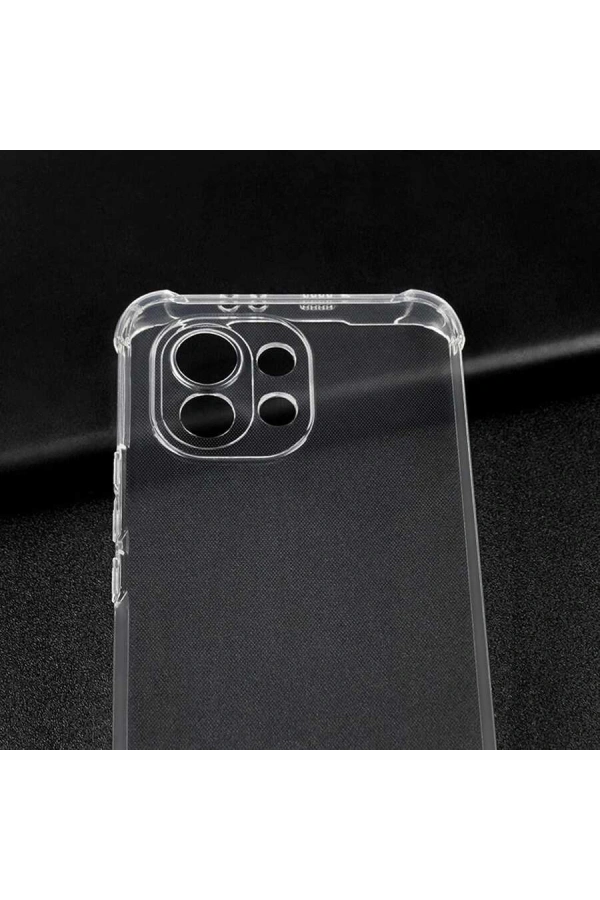 Xiaomi Mi 11 Lite Kılıf Zore Kamera Korumalı Nitro Anti Shock Silikon