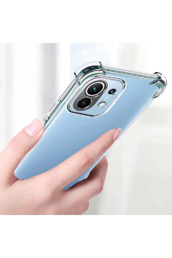 Xiaomi Mi 11 Lite Kılıf Zore Kamera Korumalı Nitro Anti Shock Silikon
