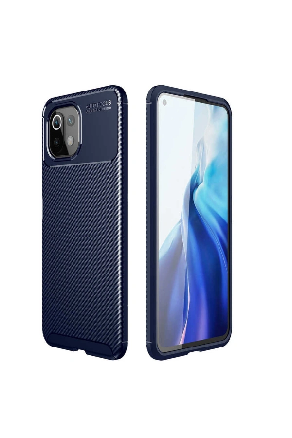 Xiaomi Mi 11 Lite Kılıf Zore Negro Silikon Kapak