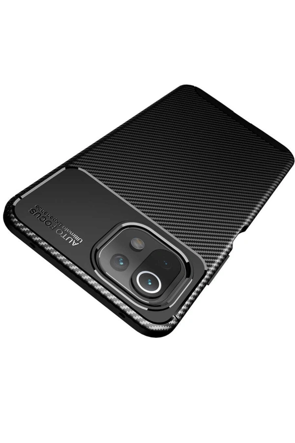 Xiaomi Mi 11 Lite Kılıf Zore Negro Silikon Kapak