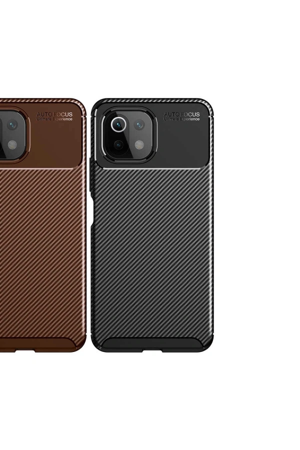 Xiaomi Mi 11 Lite Kılıf Zore Negro Silikon Kapak