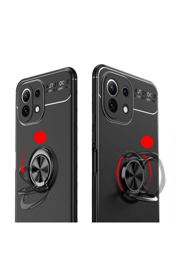 Xiaomi Mi 11 Lite Kılıf Zore Ravel Silikon Kapak